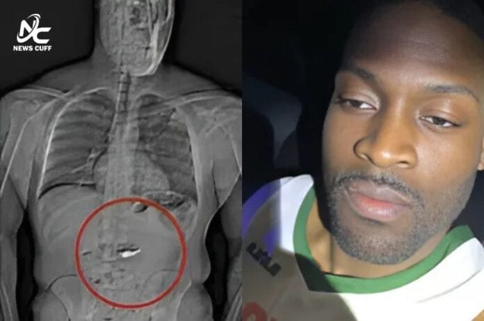 فلوریڈا میں شخص نے گرفتاری سے بچنے کے لیے 21 کروڑ مالیت کے ہیرے نگل لیے، پولیس نے حراست میں لے کر ایکسرے کیا تو پیٹ میں موجودگی کا انکشاف ہوا۔